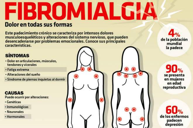 infografia que explica que es la fibromialgia.