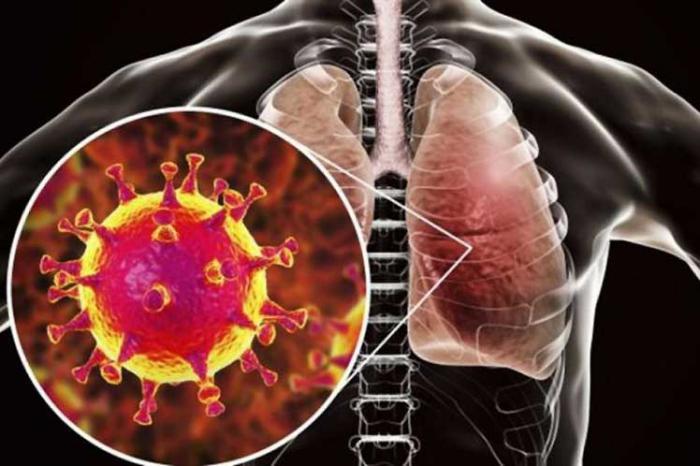 Fortalecen sistema de vigilancia para contener la introducción del coronavirus en Cuba