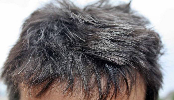 Cabello canoso