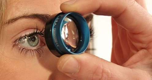 Glaucoma