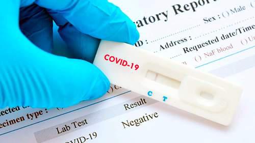tests para detectar covid