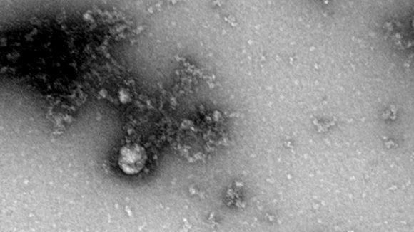 Por primera vez científicos rusos fotografían la cepa británica del coronavirus
