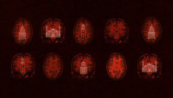 Imágenes cerebrales