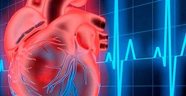 Presenta Infomed nuevo sitio web sobre Arritmia cardíaca