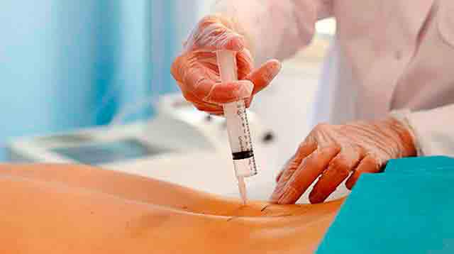 La Ozonoterapia disminuye impacto de la COVID-19 en pacientes