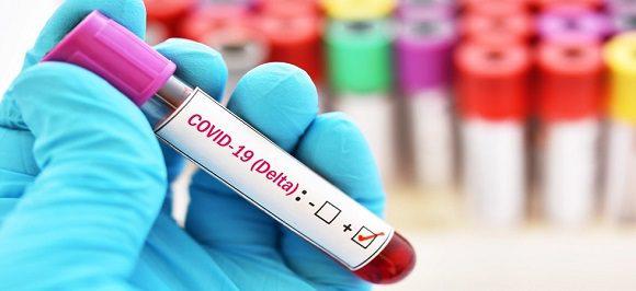 Variante delta: Desafíos e incertidumbres ante mayor incidencia 