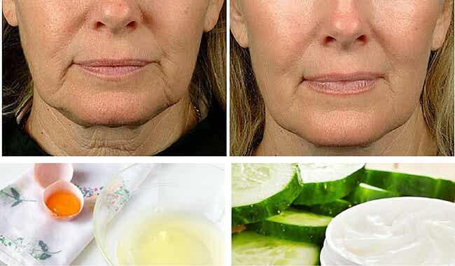 Para combatir la flacidez facial, algunos trucos caseros