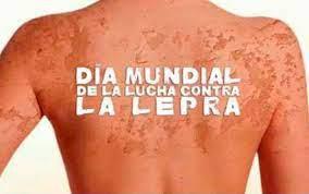 30 de enero: Día Mundial de lucha contra la Lepra 2022