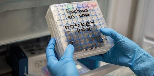 Muestras sospechosas de viruela del mono en un laboratorio de microbiología.