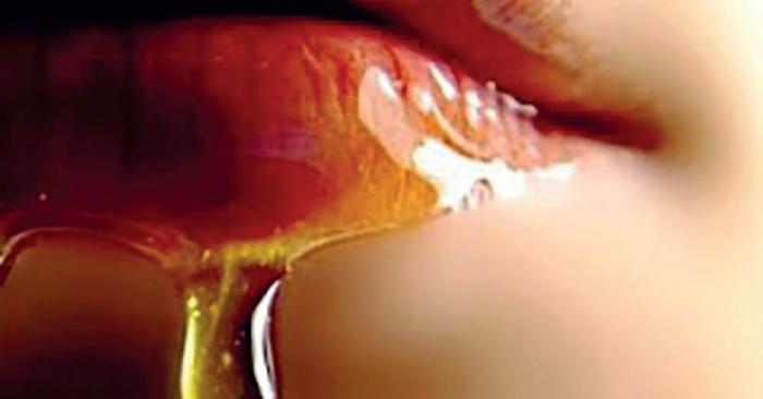 Exfoliar labios con azúcar y miel