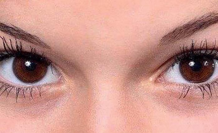 Ojos