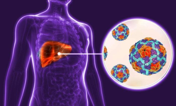 Ilustración sobre la hepatitis A